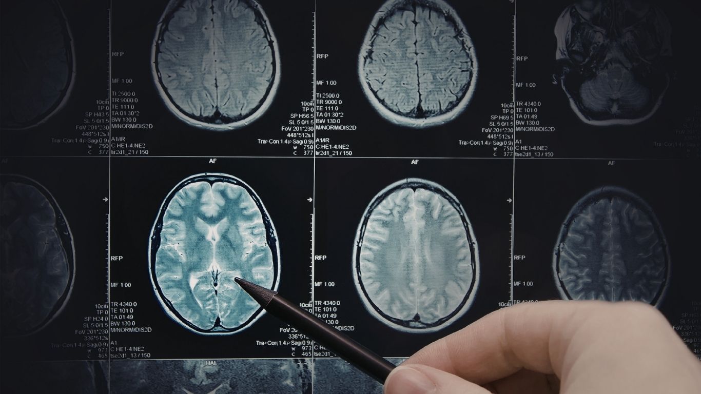 Diagnostic testing recommendations